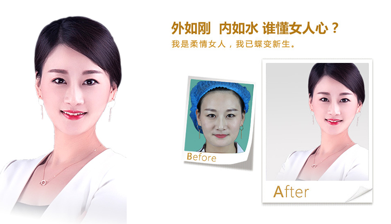 惠州V脸、线雕隆鼻